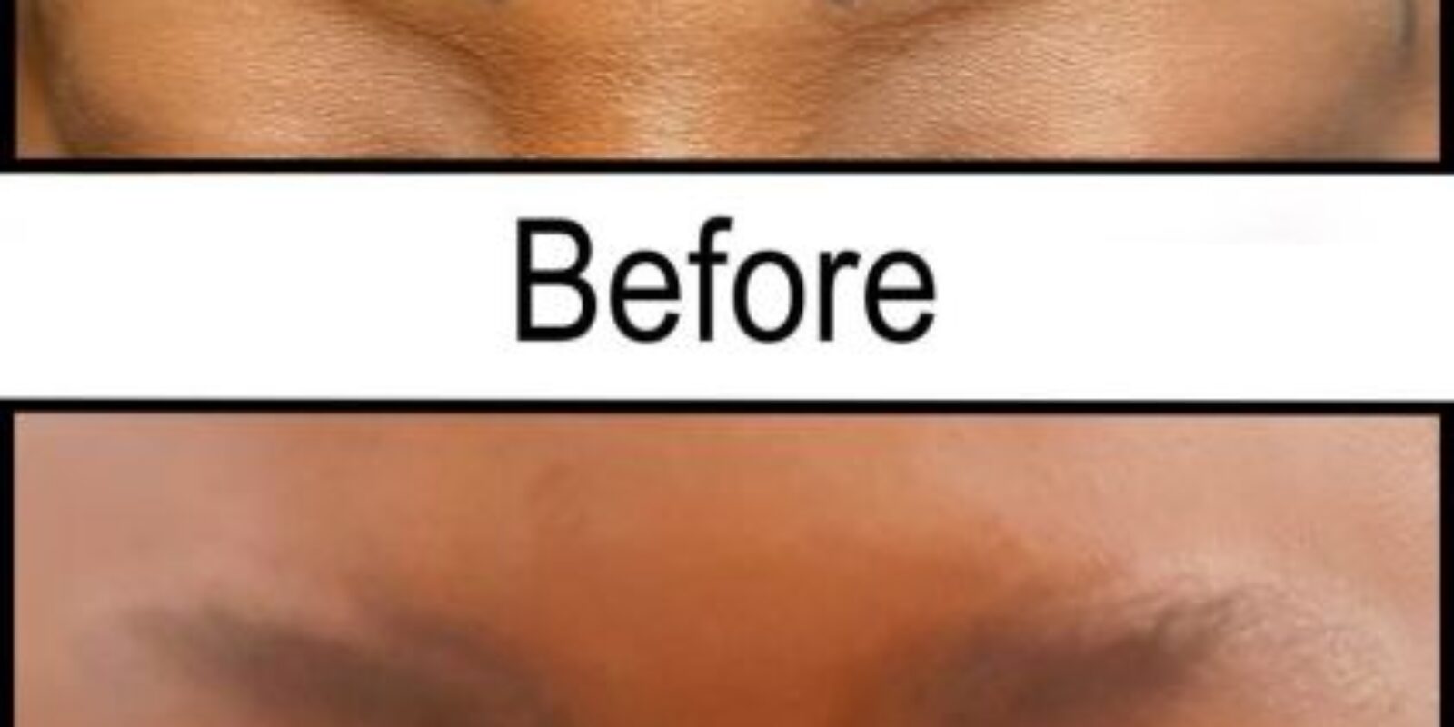 Tips to Remove Eyebrow Tattoos Safely and Effectively